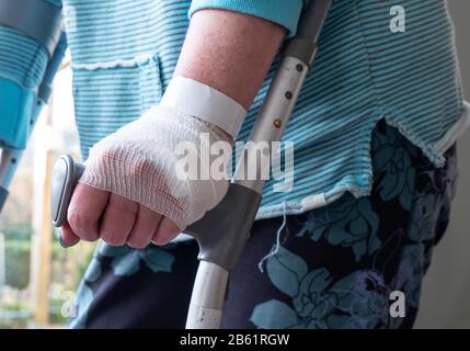 Nahaufnahme der Frau zu Fuß mit Gips und Krücken Stockfotografie - Alamy