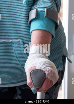 Nahaufnahme der Frau zu Fuß mit Gips und Krücken Stockfotografie - Alamy