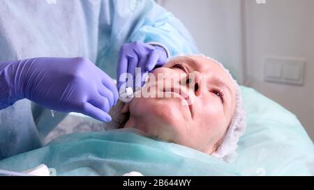 Frau im mittleren Alter 50, die eine Hebeschinjektion einer Injektion von Hyaluronsäure durch einen Arzt mit Kosmetologen ins Gesicht bekommen hat. Kosmetisches Verfahren. Schließen Stockfoto