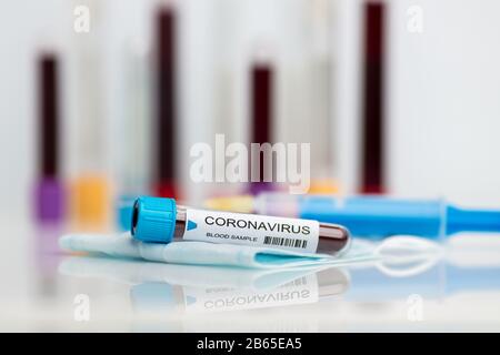 Die Laborprobe des neuartigen Coronavirus wird getestet Stockfoto