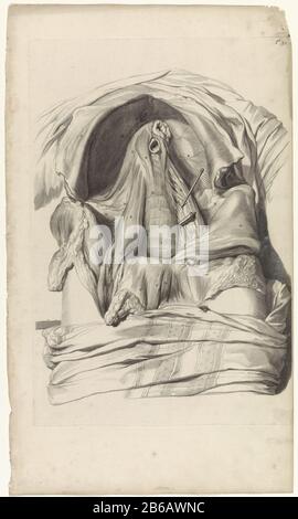 Anatomische Untersuchungen des Abdomens einer Frau anatomische Untersuchung des Abdomens einer Frau . Oben rechts mit der Nummer T. 52. Hersteller : Druckmaschine: Pieter of Grace In Zeichnung: Gerard de Lairesse Herausgeber: Witwe Joannes van Someren Verlag: Hendrick und Dirk Tree City Herstellung: Amsterdam Datum: 1685 Physikalische Eigenschaften: Engra und Punktgra-Material: Papiertechnik: Engraa (Druckverfahren) Messungen: Plattenkante b 320 mm × h 475 mmToelichtingBoekillustriatie für Bidloo, Godefridus. Anatomia humani corporis centum & Chinque tabulis per Art. G. de Lairesse ad vivum delineatis the m Stockfoto