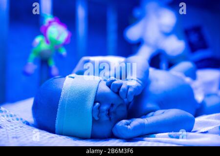 Neugeborenes, das unter ultraviolettem Licht eine Behandlung für Gelbsucht hat, Baby hat einen hohen Bilirubinspiegel, der unter blauem Licht liegt, um den Gelbsucht-Wert zu verringern. S Stockfoto