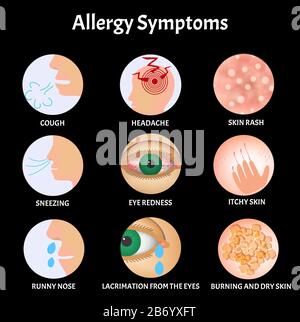 Symptome von Allergien Hautausschlag, Allergischer Hautjuckung, Tränen aus den Augen, Husten, Niesen, Laufende Nase, Kopfschmerzen, Rötungen der Augen Stock Vektor