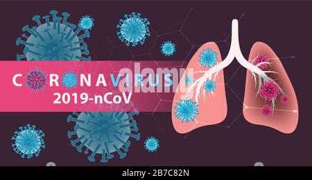 Coronavirus-Banner für Bewusstsein und Warnung vor Krankheitsausbreitung, Symptomen oder Vorsichtsmaßnahmen. Corona-Virus-Design mit infizierten Lungen und Virus-Mikroskopen Stock Vektor