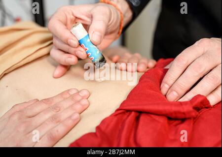 Alternative Therapeutin, die Moxibustion eine traditionelle chinesische Medizinmethode anwendet. Stockfoto