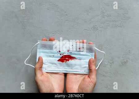 Lungenkrebs, Tuberkulose, virale Bronchitissymptome. Hämoptyse aus den Atemwegen. Mann, der Gesichtsmaske mit Hustenblut hält Stockfoto