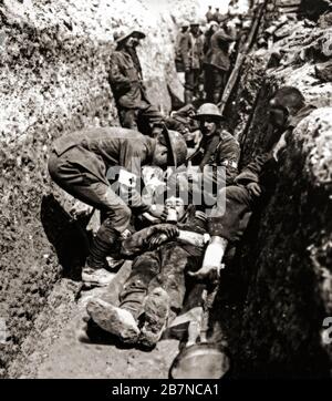 Britische Tragenträger, die einem verwundeten Soldaten während der Schlacht an der Somme Hilfe leisten, auch bekannt als Somme-Offensive, die zwischen dem 1. Juli und 18. November 1916 auf beiden Seiten des Oberlaufs der Somme in Frankreich stattfand. Stockfoto