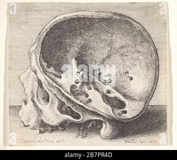 Abgeschnittenen Schädel im Profil nach links, mit der linken Seite des Kraniums entfernt, 1651. Stockfoto