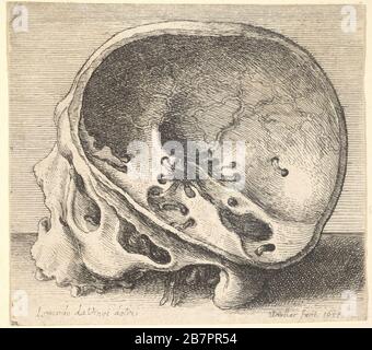 Abgeschnittenen Schädel im Profil nach links, mit der linken Seite des Kraniums entfernt, 1651. Stockfoto
