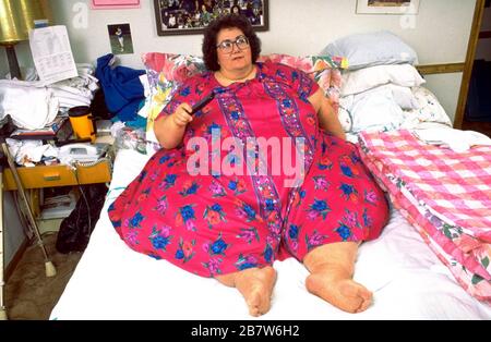 Killeen Texas USA, 1993: Krankhaft übergewichtige Frau mit einem Gewicht von über 600 kg, die aufgrund ihrer Unfähigkeit, sich sicher in ihrem Haus zu bewegen, ins Bett gesperrt wurde. HERR ©Daemmrich Stockfoto