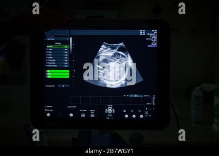 Medizinisches Ultraschallgerät mit einem 4D-Bild in einem Labor- und Auslieferungsraum in einem Krankenhaus. Stockfoto