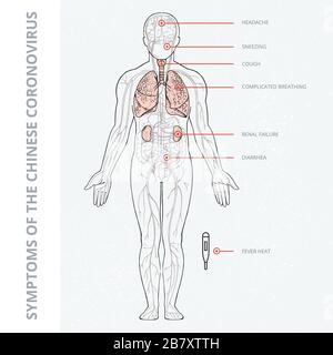 Eine schematische Darstellung des menschlichen Körpers mit einer Infografik der Symptome des Coronavirus kovid 19. Stock Vektor