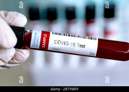 Prüfung auf Vorhandensein von Coronavirus. Röhrchen mit einer Blutprobe zur Diagnose von COVID-19. Röhren im Hintergrund. Stockfoto