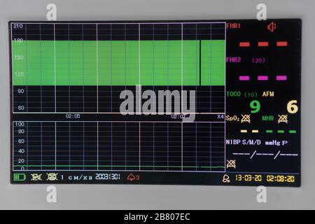 Nahanzeige eines Kardiomonitors im Stillstand. Der im Lieferumfang enthaltene Herzfrequenzsensor ohne Daten auf dem Monitor. EKG-Schreiber inaktiv. Kardiorgaph Stockfoto