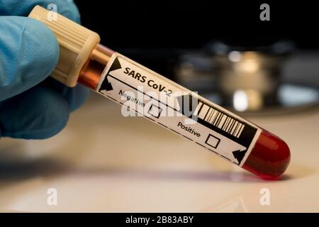SARS-COV-2 Blutprobe Nahaufnahme. Handschuhflaschen mit menschlichem Blut für die Covid-19-Tests im Labor. Globale Pandemie Outbre Stockfoto