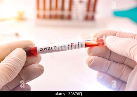 Hände mit Schutzhandschuhen, die das Reagenzglas mit Blutprobe im Labor mit dem Kovid-19-Virus aufnehmen. Draufsicht. Stockfoto