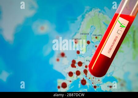 Coronavirus pandemic, nCoV 2019 positive Test, Europa Karte im Hintergrund mit sich ausbreitenden Fällen Stockfoto