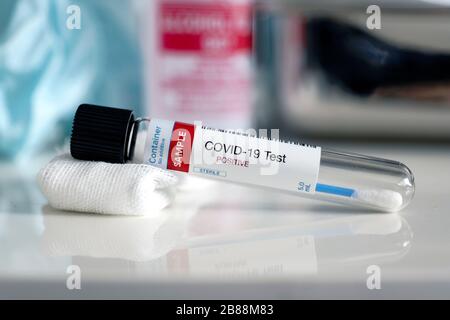 Prüfung auf Vorhandensein von Coronavirus. Röhrchen mit einer Tupfer-Probe, die positiv auf COVID-19 getestet wurde. Stockfoto