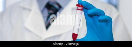 Die Hand des Arztes hält das Reagenzglas im Blut Stockfoto