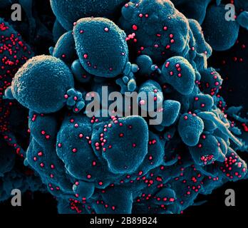 Ein Transmissionselektronenmikrograph aus COVID-19, neuartigen Coronavirus, einer apoptotischen Zelle, die stark mit SARS-COV-2-Virus-Partikeln infiziert ist, isoliert von einer Patientenprobe in der NIAID Integrated Research Facility am 18. März 2020 in Fort Detrick, Maryland. Stockfoto