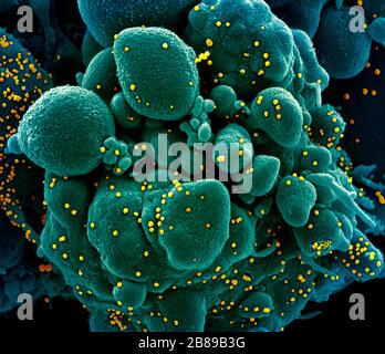 Ein Transmissionselektronenmikrograph aus COVID-19, neuartigen Coronavirus, einer apoptotischen Zelle, die stark mit SARS-COV-2-Virus-Partikeln infiziert ist, isoliert von einer Patientenprobe in der NIAID Integrated Research Facility am 19. März 2020 in Fort Detrick, Maryland. Stockfoto