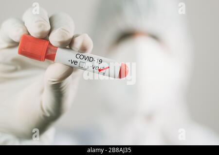 Arzt mit der Hand, der im Labor ein negatives Proben-Bluttestrohr aus Coronavirus, Kovid-19 oder 2019-nCoV hält. Stockfoto