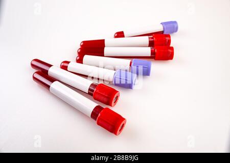 Blutschlauch mit Probenblut für Test isoliert auf weißem Hintergrund. Stockfoto