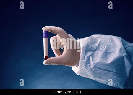 Hände eines Labortechnikers mit einem Röhrchen Blutprobe bereit für die Prüfung Stockfoto