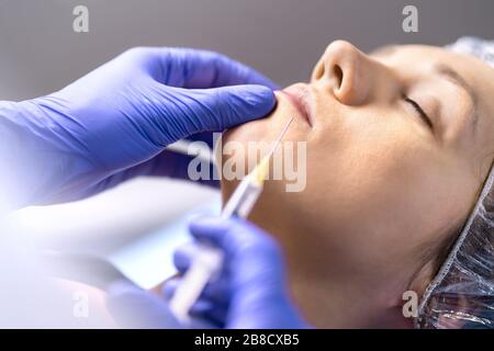 Lippeninjektion, Vergrößerung und Verbesserung in der Klinik für plastische Chirurgie mit Nadel und Spritze. Frau mit kosmetischer Behandlung. Stockfoto