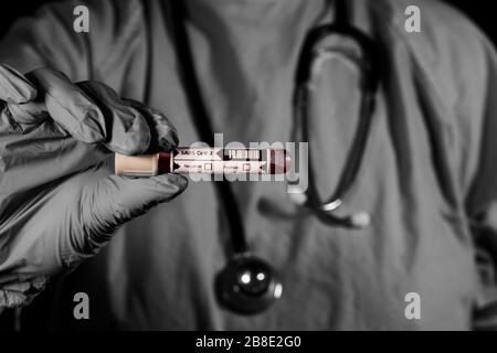 SARS-COV-2 Blutprobe Krankenschwester hält Fläschchen mit Blut. Globales Konzept für Pandemie und Infektionskrankheiten. Testin für die Virologie des schweren Atemwegssyndroms Stockfoto