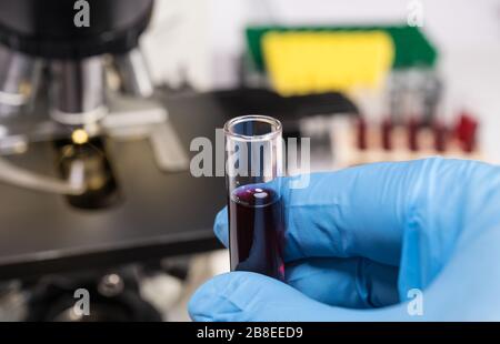 Medizinische Forschung zu Coronavirus. Hand in blauem Handschuh, der rote Flüssigkeit im Testglas hält. Klinische Probe wird von Spezialisten analysiert. Diagnostisches optisches Mikroskop. Stockfoto