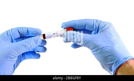 Hand in Handschuh, hält ein medizinisches Rohr mit venösem Blut. Es HCV-Verknüpfung. Verschiebt das Rohr von einer Hand zur anderen Hand. Isoliert auf einem weißen Backgroun Stockfoto