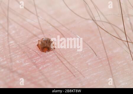 Lone Star Tick, Amblyomma americanum, Nymphe an der menschlichen Haut befestigt Stockfoto