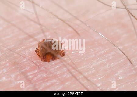 Lone Star Tick, Amblyomma americanum, Nymphe an der menschlichen Haut befestigt Stockfoto