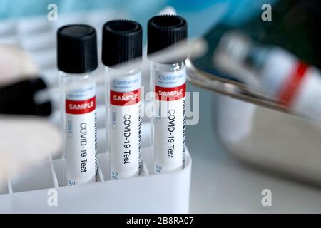 Mehrere Abstrichproben für COVID-19. Coronavirus Pandemietests. Stockfoto