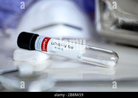 Negative Ergebnisse. Prüfung auf Vorhandensein von Coronavirus. Röhrchen mit einer Tupfer-Probe für COVID-19, die negativ getestet wurde. Stockfoto