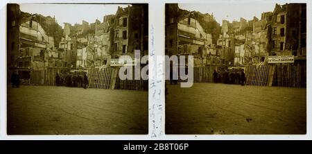 ST-SIMON LE FRANC STRASSENBRECHER MICHE, 4. BEZIRK Rue Simon-Le Franc, Rue Brise-Miche, 4. Bezirk, 4. ème, Bezirk. 1934. Photographie anonyme. Paris, musée Carnavalet. Stockfoto