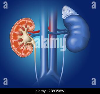 Medizinische Darstellung mit Querschnitt einer Niere mit Vena cava inferior und Aorta absteigend auf blauem Grund Stockfoto