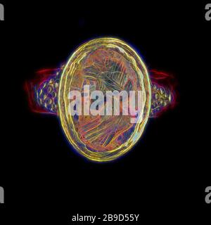 Ring, Römisches Reich, 250 - 400, Gold, Carnelian, 2,5 × 2,3 cm (1 × 7,8 Zoll, von Gibon neu vorgestellt, Design von warmem, fröhlichem Leuchten von Helligkeit und Lichtstrahlen. Klassische Kunst mit moderner Note neu erfunden. Fotografie, inspiriert vom Futurismus, die dynamische Energie moderner Technologie, Bewegung, Geschwindigkeit und Kultur revolutionieren. Stockfoto