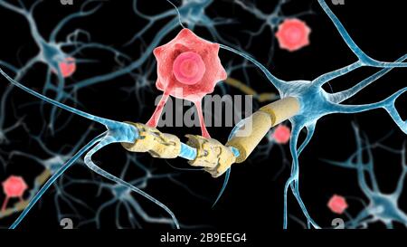 Konzeptionelles Bild eines Multiplen Sklerose-Neurons, das von einer T-Zelle geheilt wird. Stockfoto