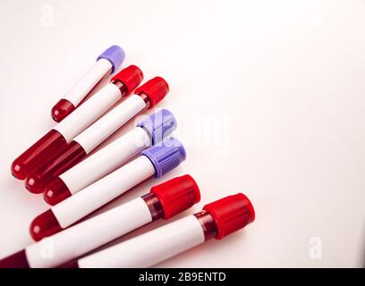 Probenröhrchen zur Blutentnahme mit leerem Testaufkleber Stockfoto