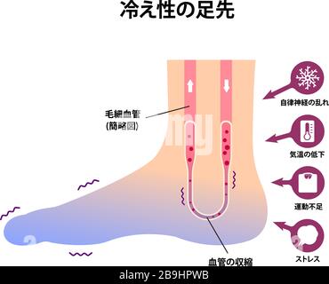 Abbildung der Kaltfußblutzirkulation (Empfindlichkeit gegenüber kalten, kalten Zehen)/Japanisch Stock Vektor