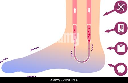 Abbildung der Kaltfußblutzirkulation (Empfindlichkeit gegenüber kalten, kalten Zehen) / kein Text Stock Vektor