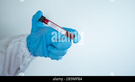 Wissenschaftler mit Schutzanzug und Coronavirus Covid 19 negative Blutprobe im Röhrchen. Impfstoffforschung des Virus 2019-nCoV im Labor. Krankheit 2019 Stockfoto