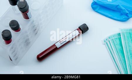 Coronavirus Covid 19-infizierte Blutprobe im Röhrchen. Impfstoffforschung des Virus 2019-nCoV im Labor. Krankheit 2019 aus Wuhan. Pandemic ansteckendes Co Stockfoto
