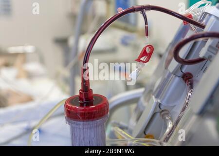 Dialyzer mit oberem Anschluss, an Backgroud-Dialysegerät auf der Intensivstation im Krankenhaus Stockfoto