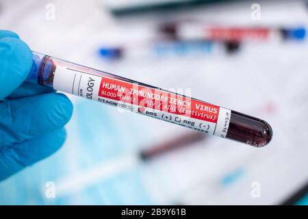 Fiktive Blutproben mit infiziertem HIV/AIDS-Virus, mit Stethoskop, Maske und Spritze und anderem. Stockfoto