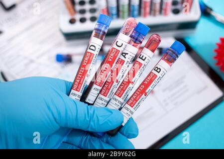 Fiktive Blutproben mit infiziertem Hepatitisvirus, mit Stethoskop, Maske und Spritze und anderem. Stockfoto