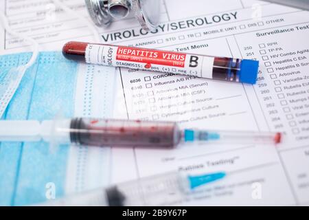 Fiktive Blutproben mit infiziertem Hepatitis B-Virus, mit Maske, Spritze und Laborbericht. Stockfoto