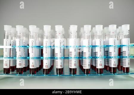 Positive Ergebnisse von Corona-Virustests. Viele Blutproben in einem speziellen Laborhalter. Stockfoto
